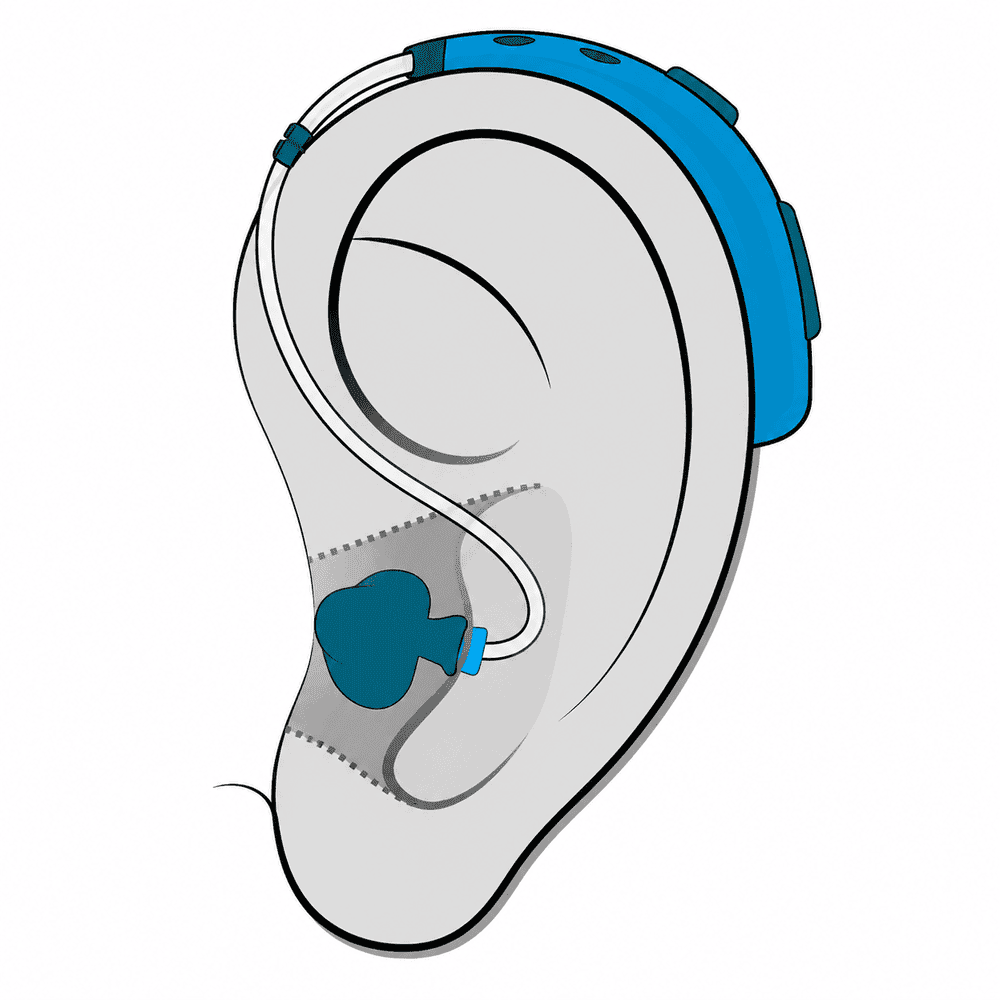 Behind-the-Ear (BTE) hearing aid style available at Optimum Audiology in the High Desert