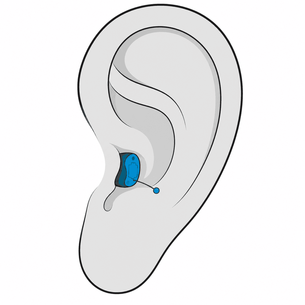 Completely-in-Canal (CIC) hearing aid style available at Optimum Audiology in Visalia, CA