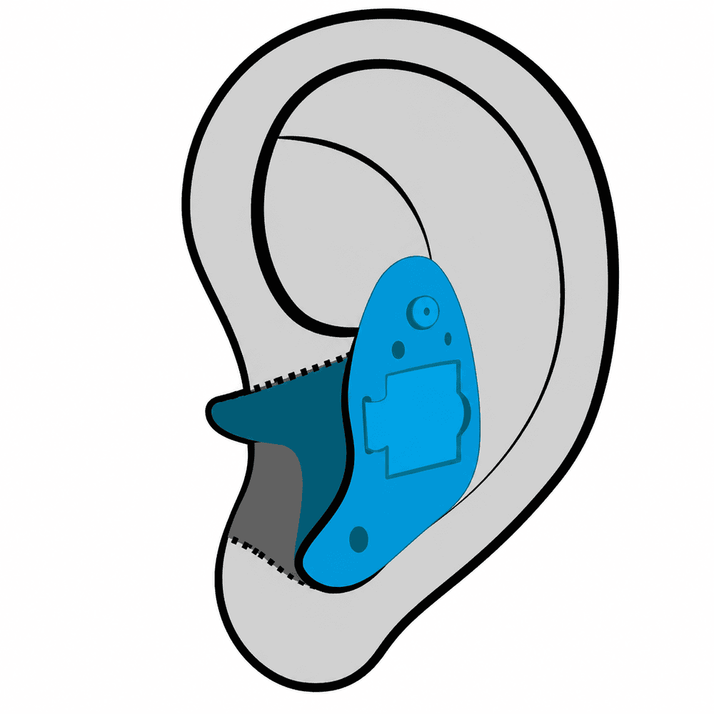 In-the-Ear (ITE) custom hearing aid style available at Optimum Audiology in Jess Ranch, Apple Valley