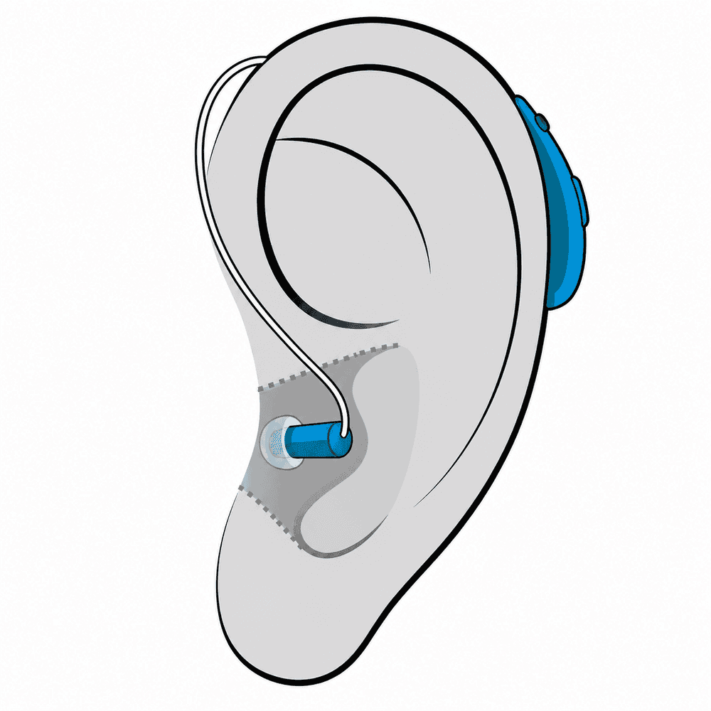 Receiver-in-Canal (RIC) hearing aid style fitted at Optimum Audiology in Apple Valley, CA